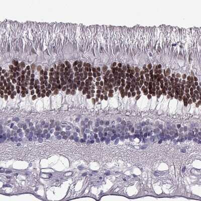 Immunohistochemistry-Paraffin: CRX/CORD2 Antibody [NBP1-88060]