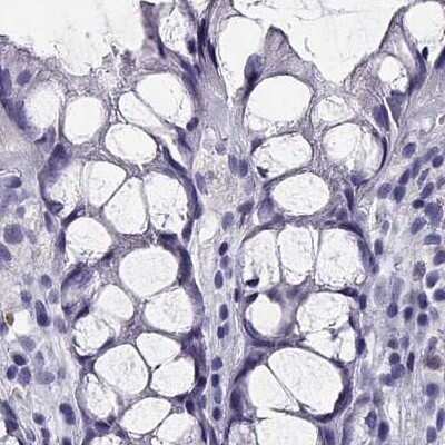 Immunohistochemistry-Paraffin: CRX/CORD2 Antibody [NBP1-88060]