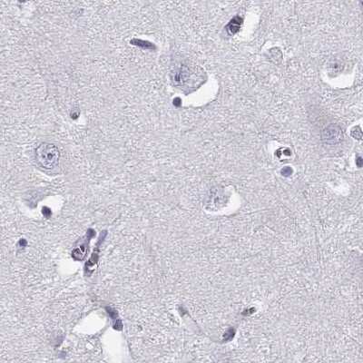 Immunohistochemistry-Paraffin: CRX/CORD2 Antibody [NBP1-88060]