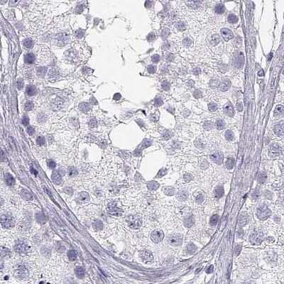 Immunohistochemistry-Paraffin: CRX/CORD2 Antibody [NBP1-88060]
