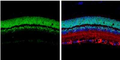 Immunohistochemistry-Paraffin: CRX/CORD2 Antibody [NBP2-15964]
