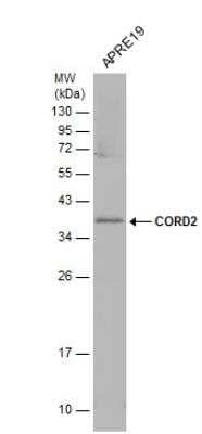 Western Blot: CRX/CORD2 Antibody [NBP2-15964]
