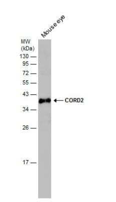 Western Blot: CRX/CORD2 Antibody [NBP2-15964]