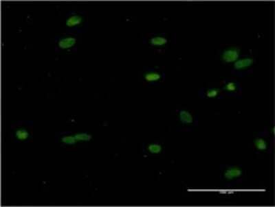 Immunocytochemistry/ Immunofluorescence: CRY1 Antibody (2G4-1F6) [H00001407-M02]