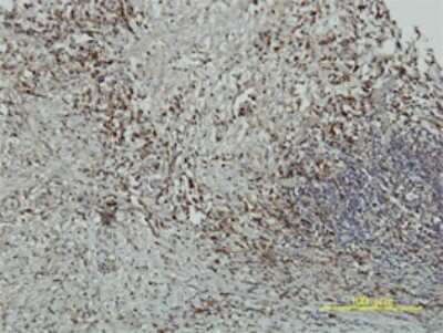 Immunohistochemistry-Paraffin: CRY1 Antibody (4H4-1C4) [H00001407-M01]