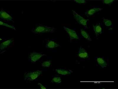 Immunocytochemistry/ Immunofluorescence: CRY1 Antibody [H00001407-B01P]