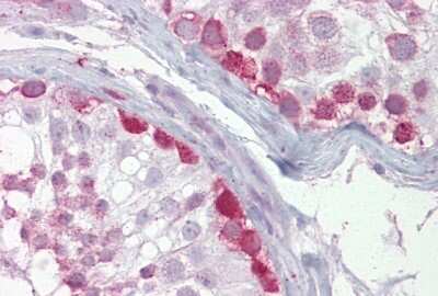 Immunohistochemistry-Paraffin: CRY1 Antibody [NBP1-69080]