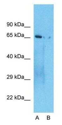 Western Blot: CRY1 Antibody [NBP1-69080]