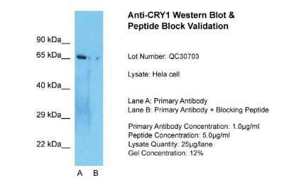 Western Blot: CRY1 Antibody [NBP1-69080]