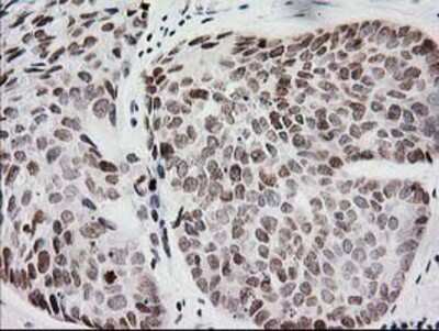 Immunohistochemistry-Paraffin: CRY2 Antibody (OTI1H5) [NBP2-00749]