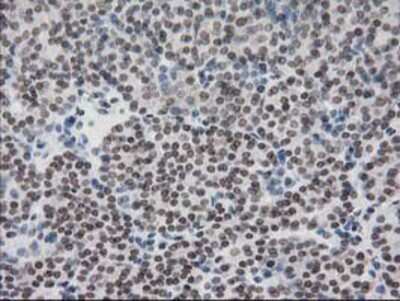 Immunohistochemistry-Paraffin: CRY2 Antibody (OTI1H5) [NBP2-00749]