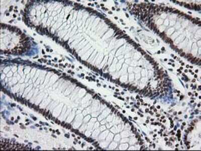 Immunohistochemistry-Paraffin: CRY2 Antibody (OTI1H5) [NBP2-00749]