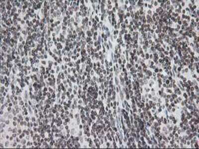 Immunohistochemistry-Paraffin: CRY2 Antibody (OTI1H5) [NBP2-00749]