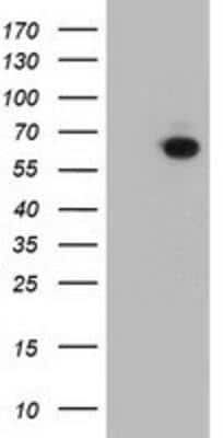 Western Blot: CRY2 Antibody (OTI1H5) [NBP2-00749]