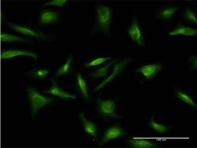 Immunocytochemistry/ Immunofluorescence: CRY2 Antibody (3H4) [H00001408-M03]