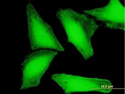 Immunocytochemistry/ Immunofluorescence: CRY2 Antibody [H00001408-B01P]