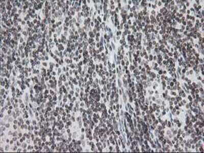 Immunohistochemistry: CRY2 Antibody (OTI1H5) - Azide and BSA Free [NBP2-70449]