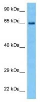 Western Blot: CRY2 Antibody [NBP3-10833]