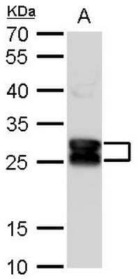Western Blot: CRYBA1 Antibody [NBP1-33010]