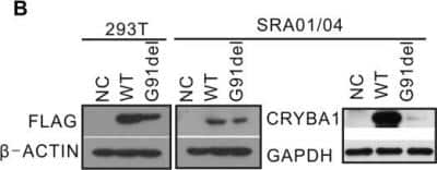 Western Blot: CRYBA1 Antibody [NBP1-33010]