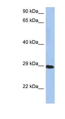 Western Blot: CRYBA1 Antibody [NBP1-52907]