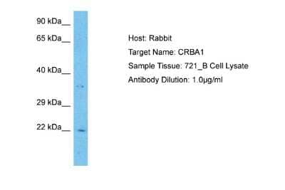 Western Blot: CRYBA1 Antibody [NBP2-87214]