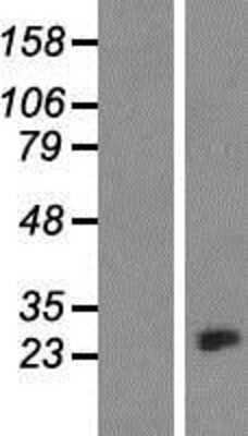 Western Blot: CRYBA1 Overexpression Lysate [NBP2-07777]