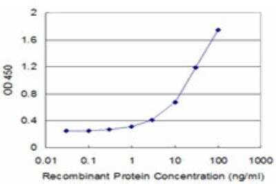 ELISA: CRYBA2 Antibody (2G9) [H00001412-M04]