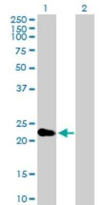 Western Blot: CRYBA2 Antibody [H00001412-B01P]