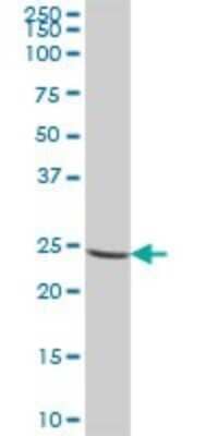 Western Blot: CRYBA2 Antibody [H00001412-B02P]