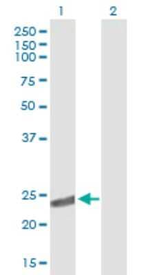 Western Blot: CRYBA2 Antibody [H00001412-B02P]