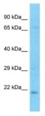 Western Blot: CRYBA2 Antibody [NBP3-10777]