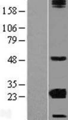 Western Blot: CRYBA2 Overexpression Lysate [NBL1-09498]