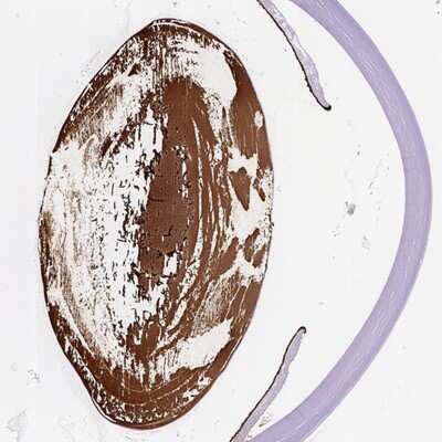 Immunohistochemistry-Paraffin: CRYBA4 Antibody [NBP2-57040]