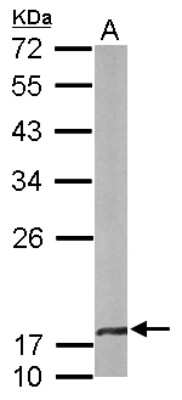 Western Blot: CRYBA4 Antibody [NBP1-32741]