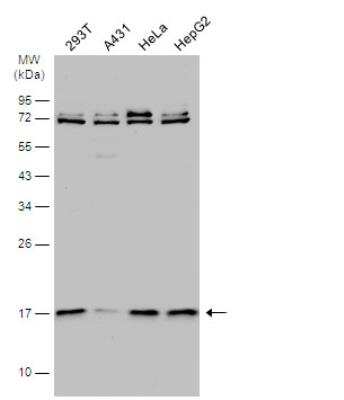 Western Blot: CRYBA4 Antibody [NBP1-32741]