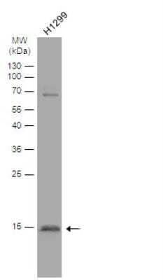 Western Blot: CRYBA4 Antibody [NBP1-32741]