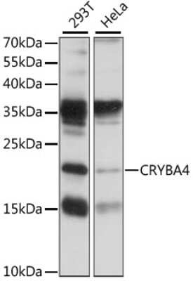 Western Blot: CRYBA4 AntibodyAzide and BSA Free [NBP2-92223]