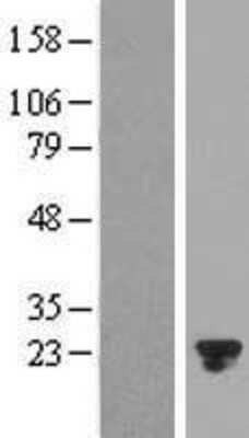 Western Blot: CRYBA4 Overexpression Lysate [NBP2-08166]