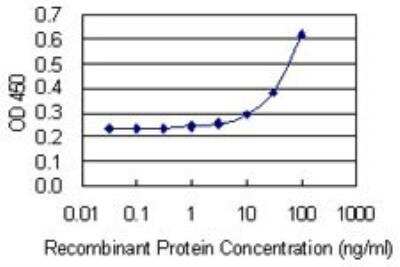 ELISA: CRYBB2 Antibody (1F1) [H00001415-M02]