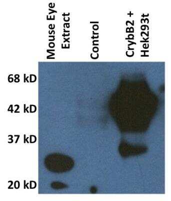 Western Blot: CRYBB2 Antibody (1F1) [H00001415-M02]