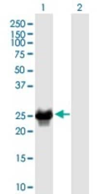 Western Blot: CRYBB2 Antibody (1F1) [H00001415-M02]