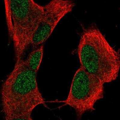 Immunocytochemistry/ Immunofluorescence: CRYBB2 Antibody [NBP2-13876]