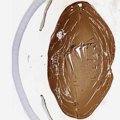 Immunohistochemistry-Paraffin: CRYBB2 Antibody [NBP2-13876]