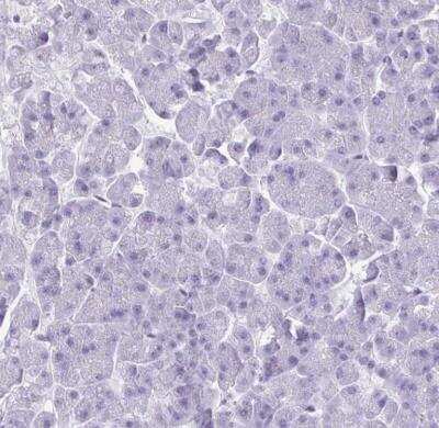 Immunohistochemistry-Paraffin: CRYBB2 Antibody [NBP2-13876]