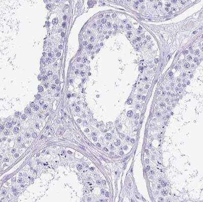 Immunohistochemistry-Paraffin: CRYBB2 Antibody [NBP2-13876]