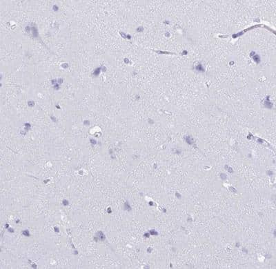 Immunohistochemistry-Paraffin: CRYBB2 Antibody [NBP2-13876]