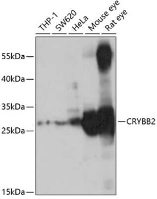 Western Blot: CRYBB2 AntibodyBSA Free [NBP2-92459]