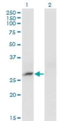 Western Blot: CRYBB3 Antibody (4H6) [H00001417-M01]