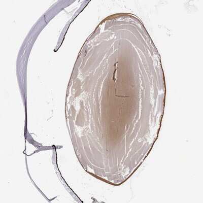 Immunohistochemistry-Paraffin: CRYBB3 Antibody [NBP2-49196]